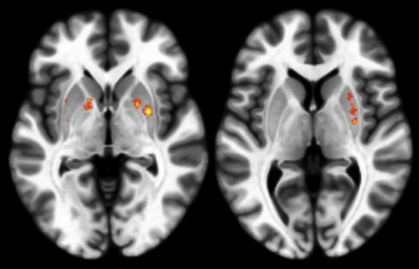 7T fMRI motor learning figure